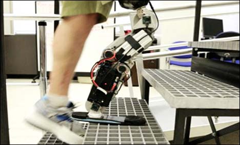 First artificial leg developed which move on the brain signals